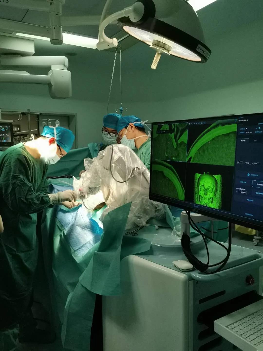 山东大学齐鲁医院神经外科近日完成4例难治性癫痫的SEEG定位评估