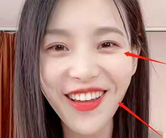 千万网红小贝近况堪忧，面容憔悴法令纹深，网友：都是催吐惹的祸