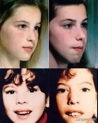 宝宝偏头睡觉怎么纠正最有效,一岁宝宝偏头睡觉如何矫正