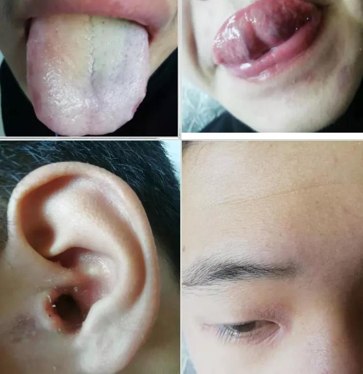 皮肤祛湿的方法,要想皮肤好排毒少不了