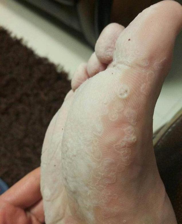 脚臭怎么紧急补救,脚臭如何1秒解决