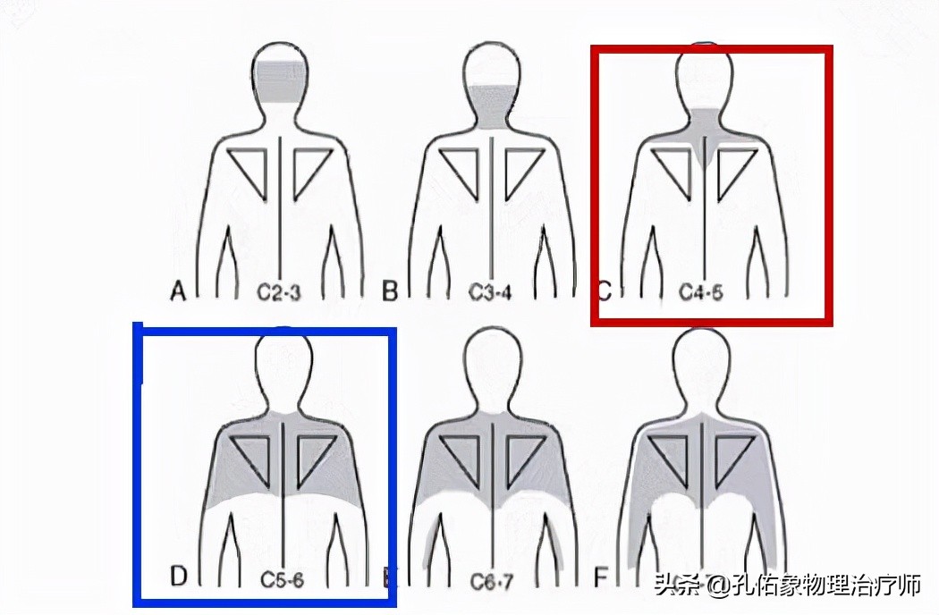 肩膀和肩胛骨疼痛如何治疗,左肩膀和肩胛骨内侧肌肉会疼