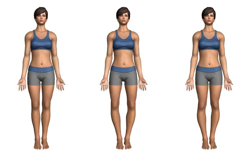 o型腿膝外侧关节疼痛,o型腿膝盖疼最好锻炼方法