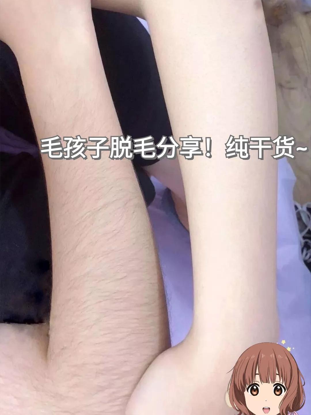 教你一个简单的脱毛方法,永久不再生毛的脱毛小妙招