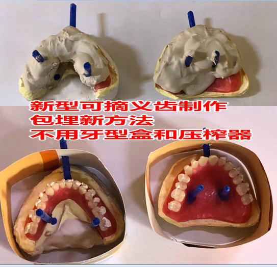 假牙制作纯手工,假牙新材料制作方法