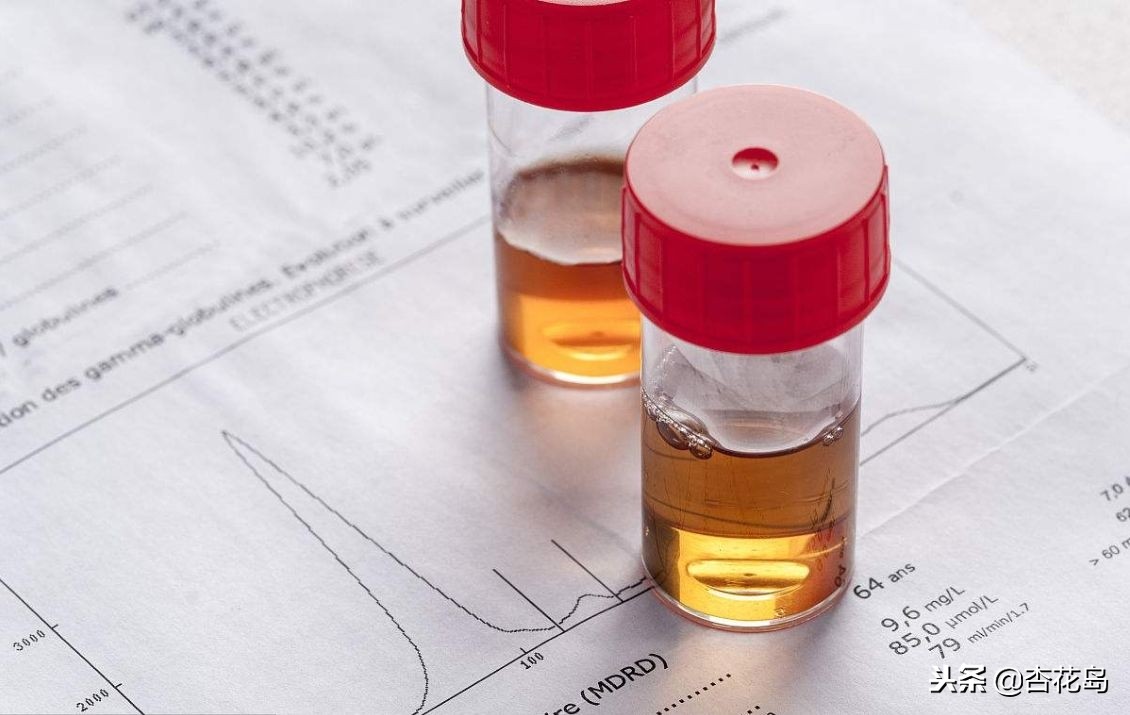 尿酸偏高多少才需要治疗呢,医院可以查出尿酸偏高的原因吗