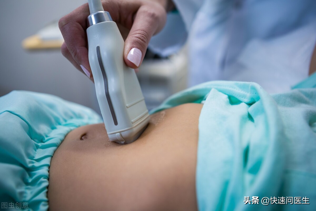 药流怎样知道有没有排出,药流干净小技巧一招搞定药流