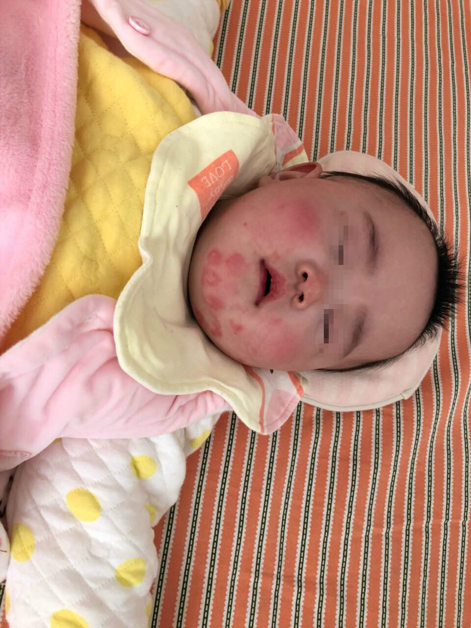 氨基酸奶粉深度水解,氨基酸奶粉和深度水解奶粉选哪个