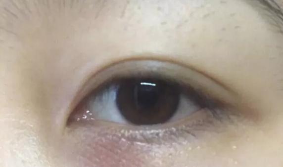 雅诗兰黛和兰蔻小黑瓶眼霜哪款好,兰蔻小黑瓶和雅诗兰黛眼霜哪个好