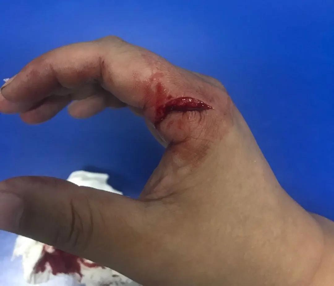 附视频丨徒手夺刀，鲜血直流，他到底为啥？