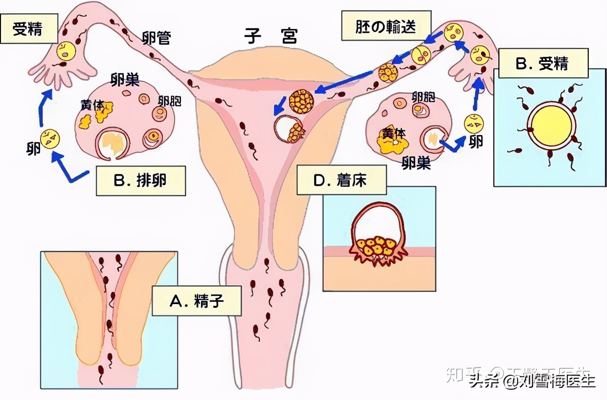 刘雪梅医生科普：流产后一直怀不上，为什么建议你尽快去做造影