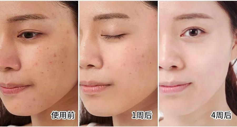 美白祛黄提亮肤色泡水喝,每天喝一杯可以美白淡斑清热解毒