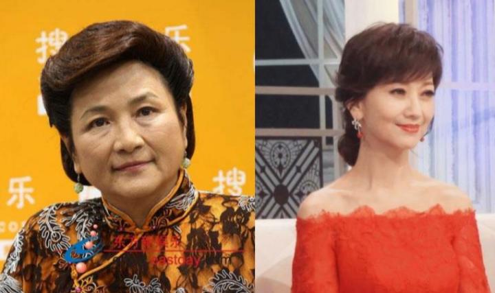 抗衰不再是简单的面部抗衰,风靡全球面部抗衰的最好方法