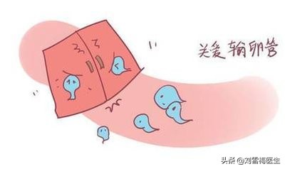 怎么才能知道输卵管是否通畅,怎么知道输卵管是否通畅