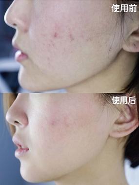 真正有效的芦荟胶,安全好用的芦荟胶