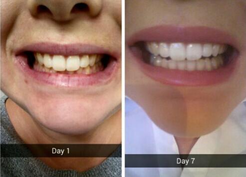 抽烟人的牙膏推荐,澳洲本命牙膏测评