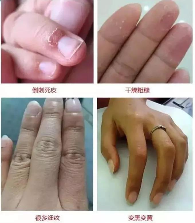 日本敏感皮肤面霜,日本人五合一面霜