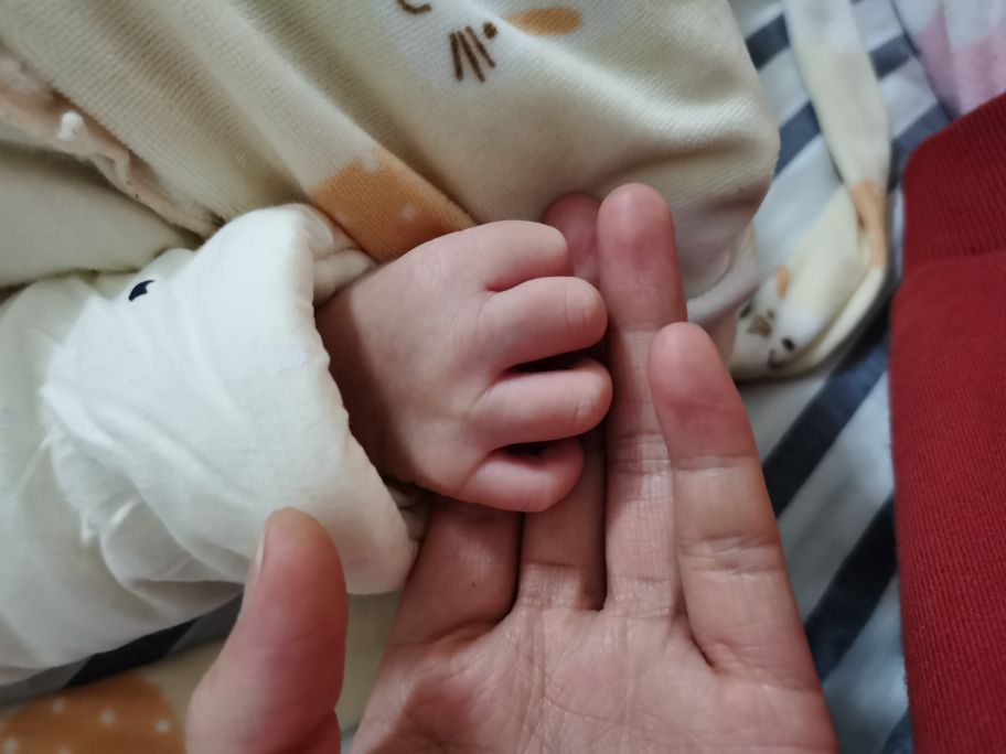 皮肤受伤疤痕修复,疤痕体质受伤后怎么不留疤