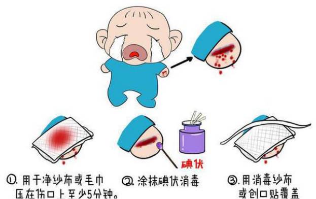 孩子磕破皮以后如何好得更快,宝宝磕破皮出血怎么处理