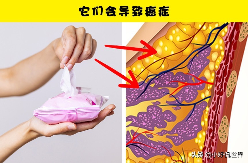化妆湿巾有什么好处,经常用湿巾的危害