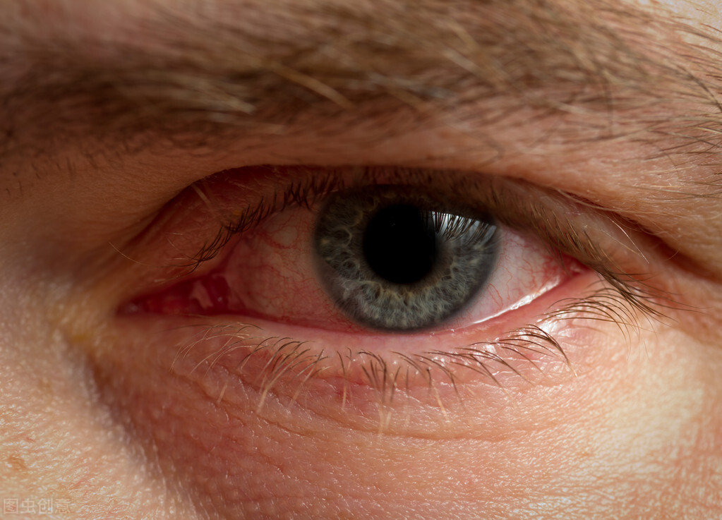 屁的主要成分硫化氢有毒吗,恶臭气体中的硫化氢危害有多大