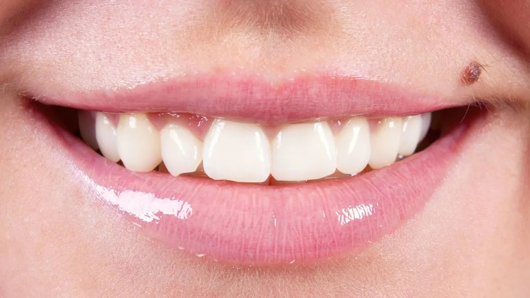 牙齿断裂有什么预兆,牙齿断裂伤到牙髓会怎么样