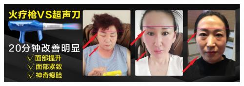 琦草集按摩霜,琦草集艾灸