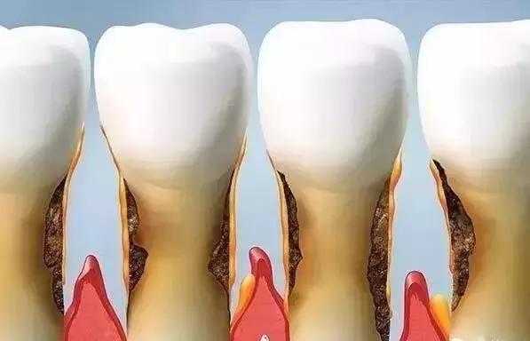 每年洗一次牙对牙齿有伤害吗,洗一次牙大概多少钱左右