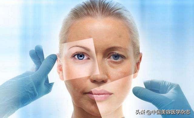 【5期专栏述评】*褐斑黄**需要长期防治与综合管理（全文）