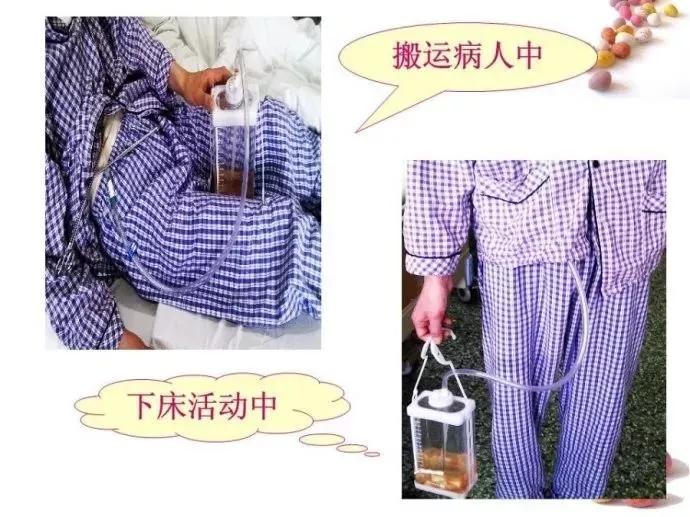 护士观察瞳孔注意事项,胸腔闭式引流的护理及注意事项