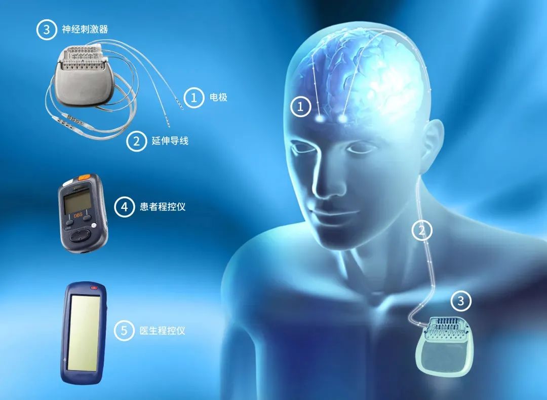 手抖，拿不起筷子，特发性震颤该怎么治疗？