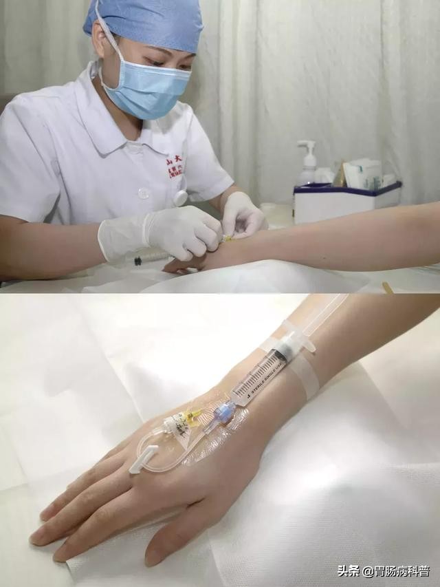 医生做胃镜检查时会看食道的吗,胃镜检查全过程视频消化内科检查