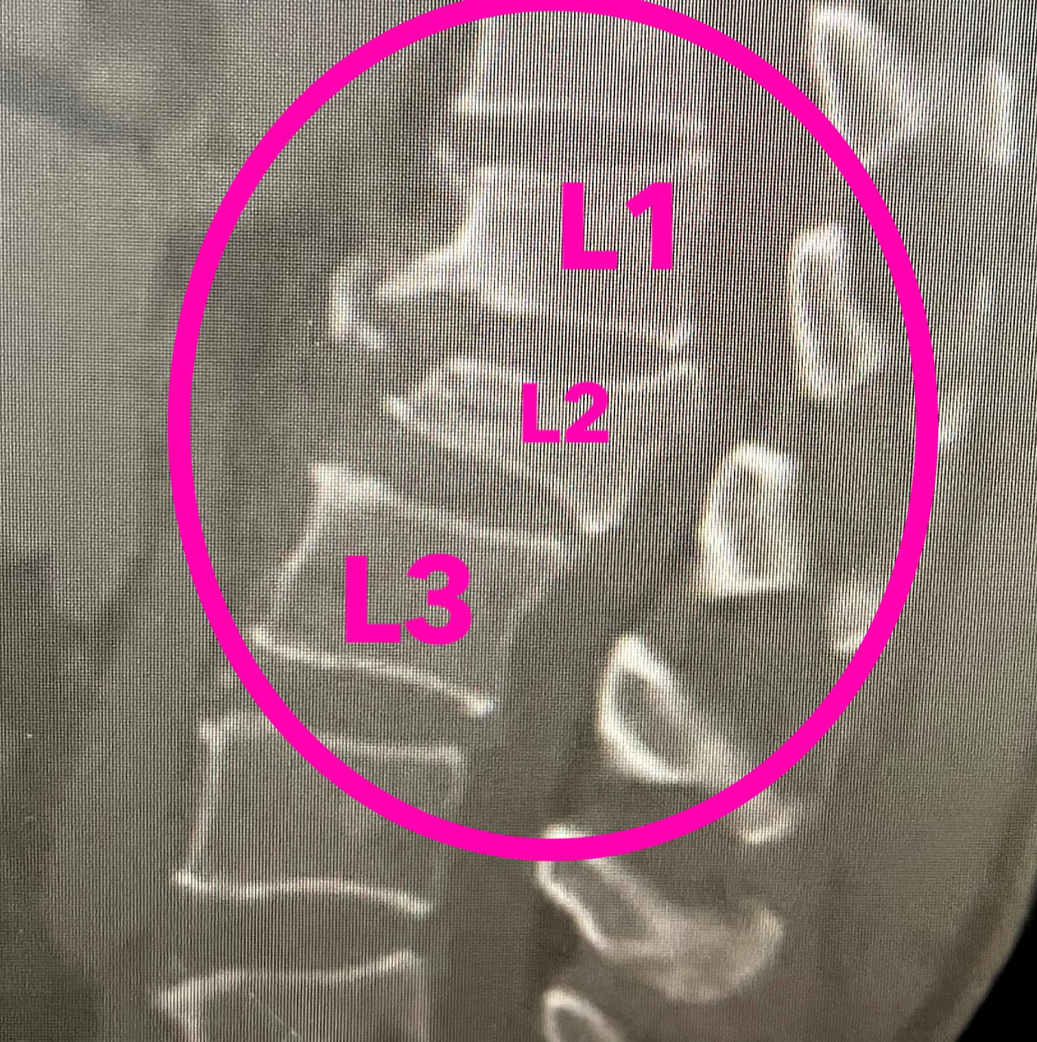 分秒必争救伤员,分秒必争的抢救