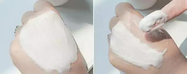 *血丝红**还有救吗？看完这篇你就知道啦