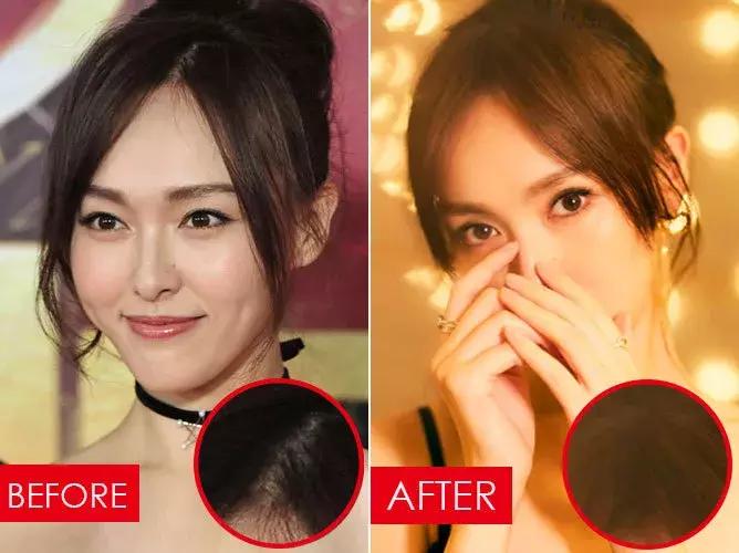 张歆艺防止妊娠纹,张歆艺预防妊娠纹