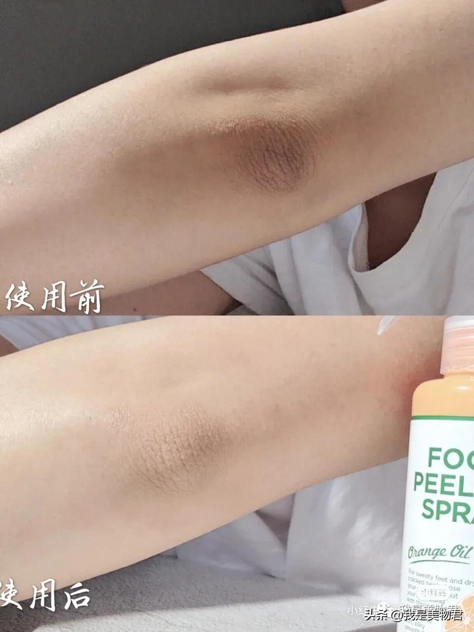 不做足部护理怎么穿凉鞋,不做足部美甲穿凉鞋好看吗