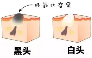 去黑头牙膏真实测评,牙膏去黄口测评