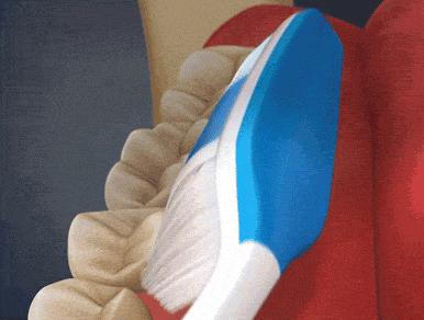 如何治疗和预防牙周炎,牙周炎日常防护