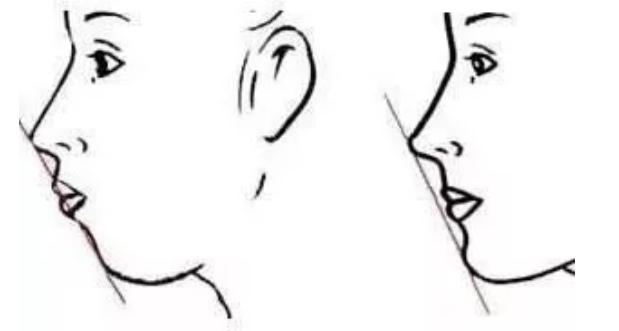如何让侧颜变得好看,想拥有更好的线条
