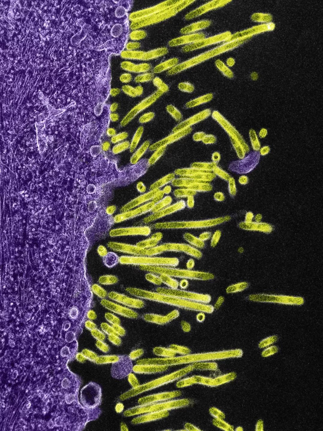 人体防卫战,人体痛点攻击技巧