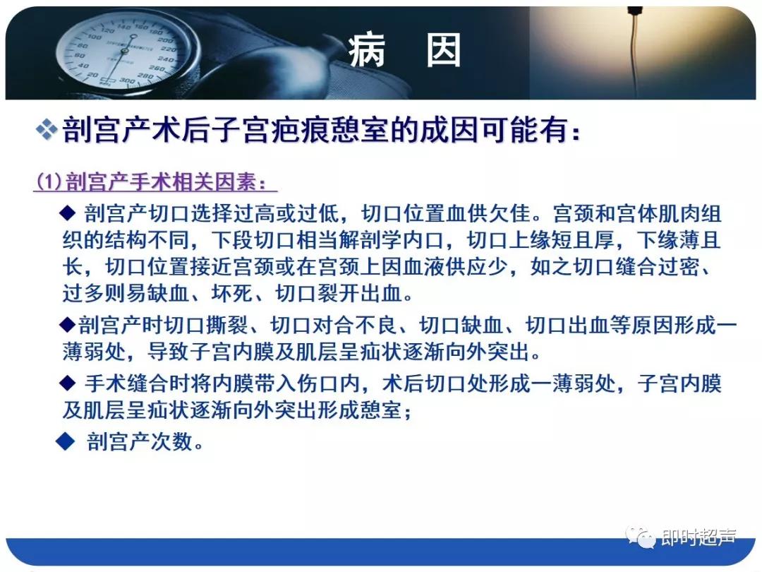 孕妇剖宫产瘢痕憩室,剖宫产瘢痕憩室息肉