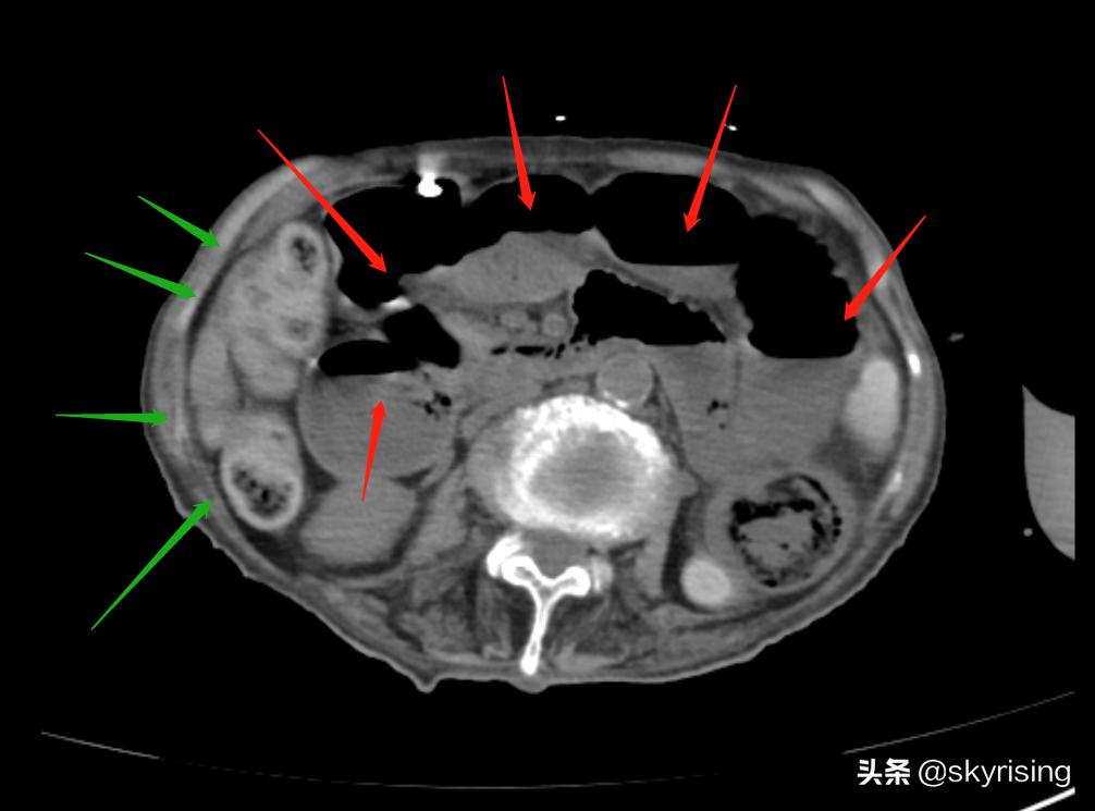老人术后并发症,老年人术后风险有哪些