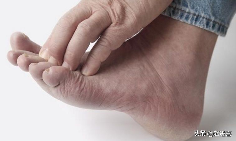 糖尿病人下肢脚麻痛应做什么检查,糖尿病手麻脚麻是什么症状