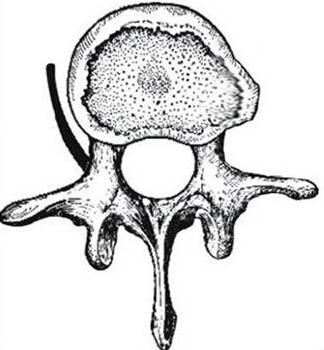 骨科医生告诉你：腰椎间盘突出、膨出、脱出都有什么区别？