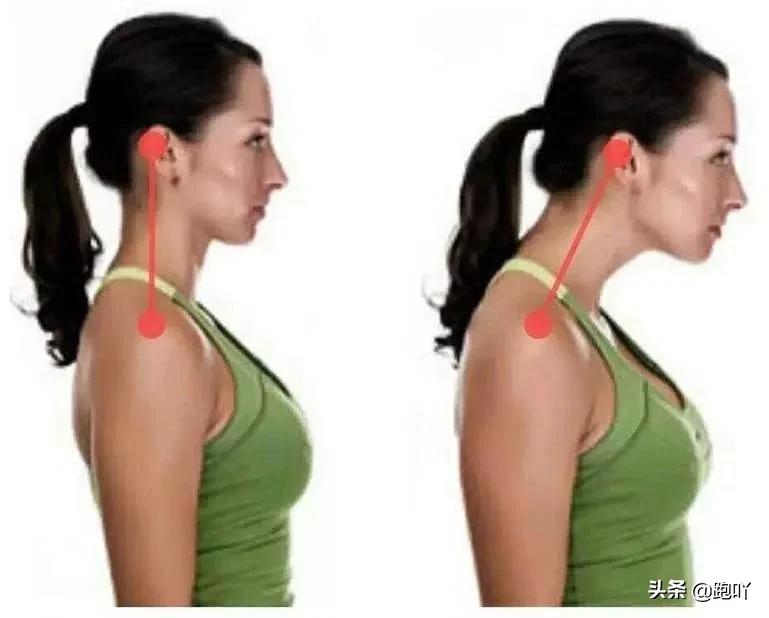 跑后肩部疼痛最快缓解方法,肩颈酸痛是什么原因