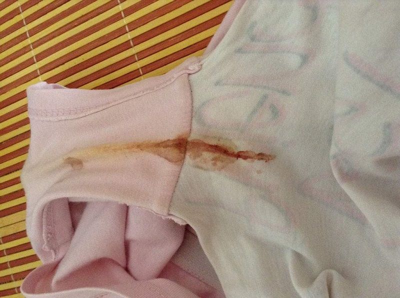 孕妈发现有分泌物,孕中期内裤上黄分泌物正常吗