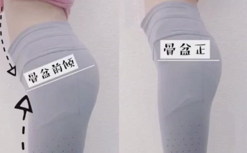 骨盆前倾怎么练翘臀,骨盆前倾最有效果纠正动作