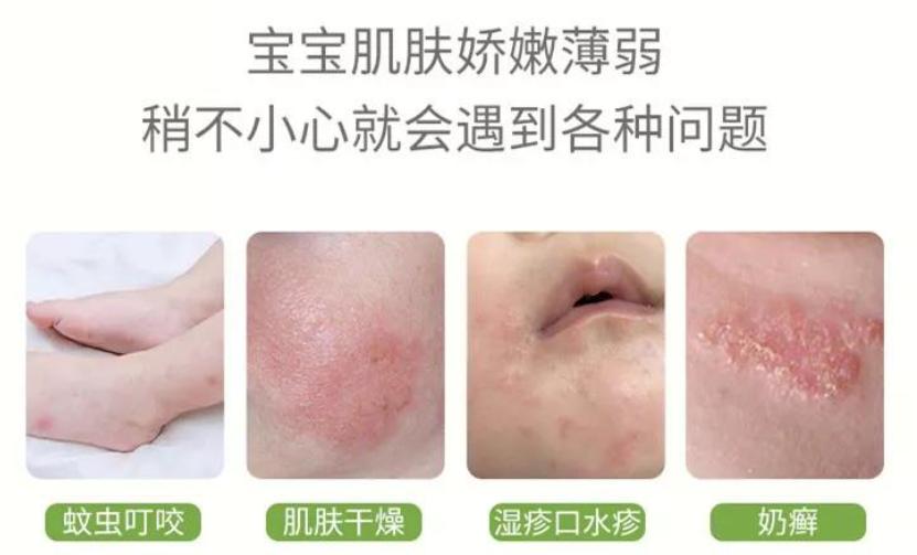 木瓜膏的主要功效,神奇的木瓜膏