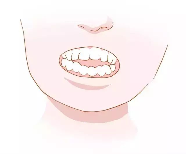 牙齿矫正全过程都在这里了,牙齿矫正一定要知道的事儿