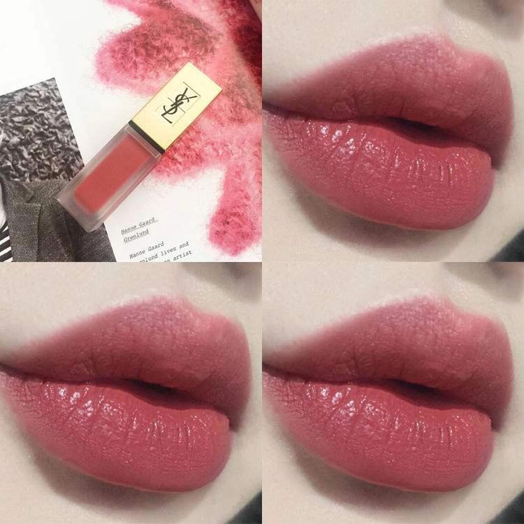 骨相凹陷怎么办,骨相扁平怎么改善